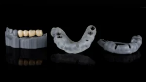 CIRURGIA GUIADA DE IMPLANTES DENTÁRIOS