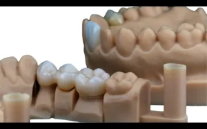 odontologia belem proteses FIXAS