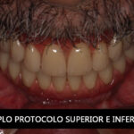 DUPLO-PROTIOCOLO