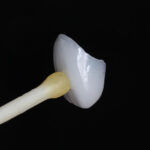 Lente de contato pronta para cimentação em boca