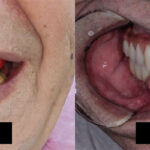 antes-e-depois2