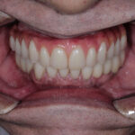 Sorriso final.